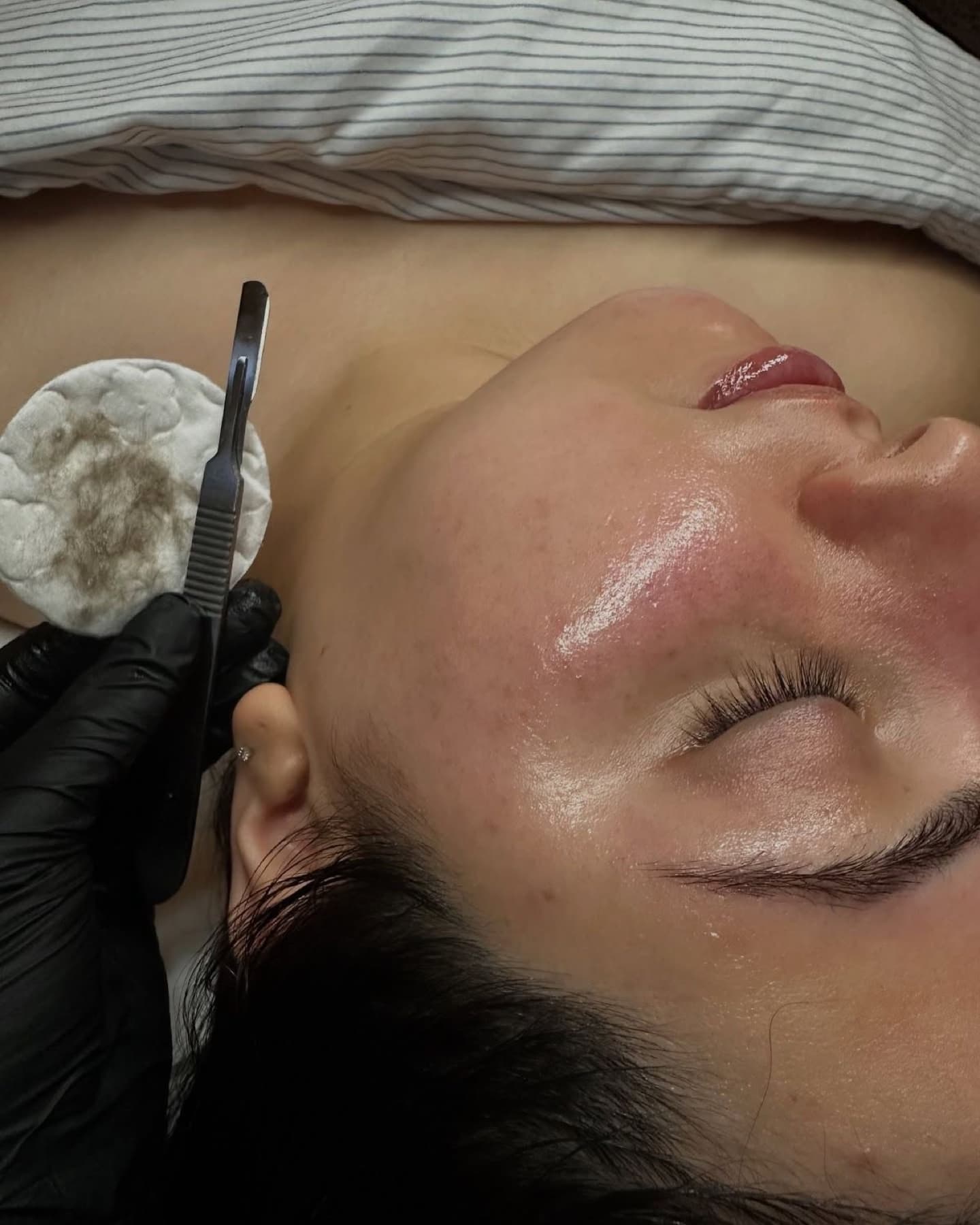 Dermaplaning treatment in progress at Ella’s Beauty